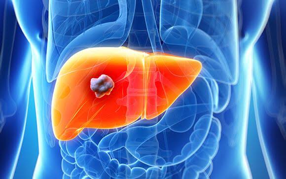 Se suma SESA a la conmemoración del Día Mundial del Cáncer de Hígado