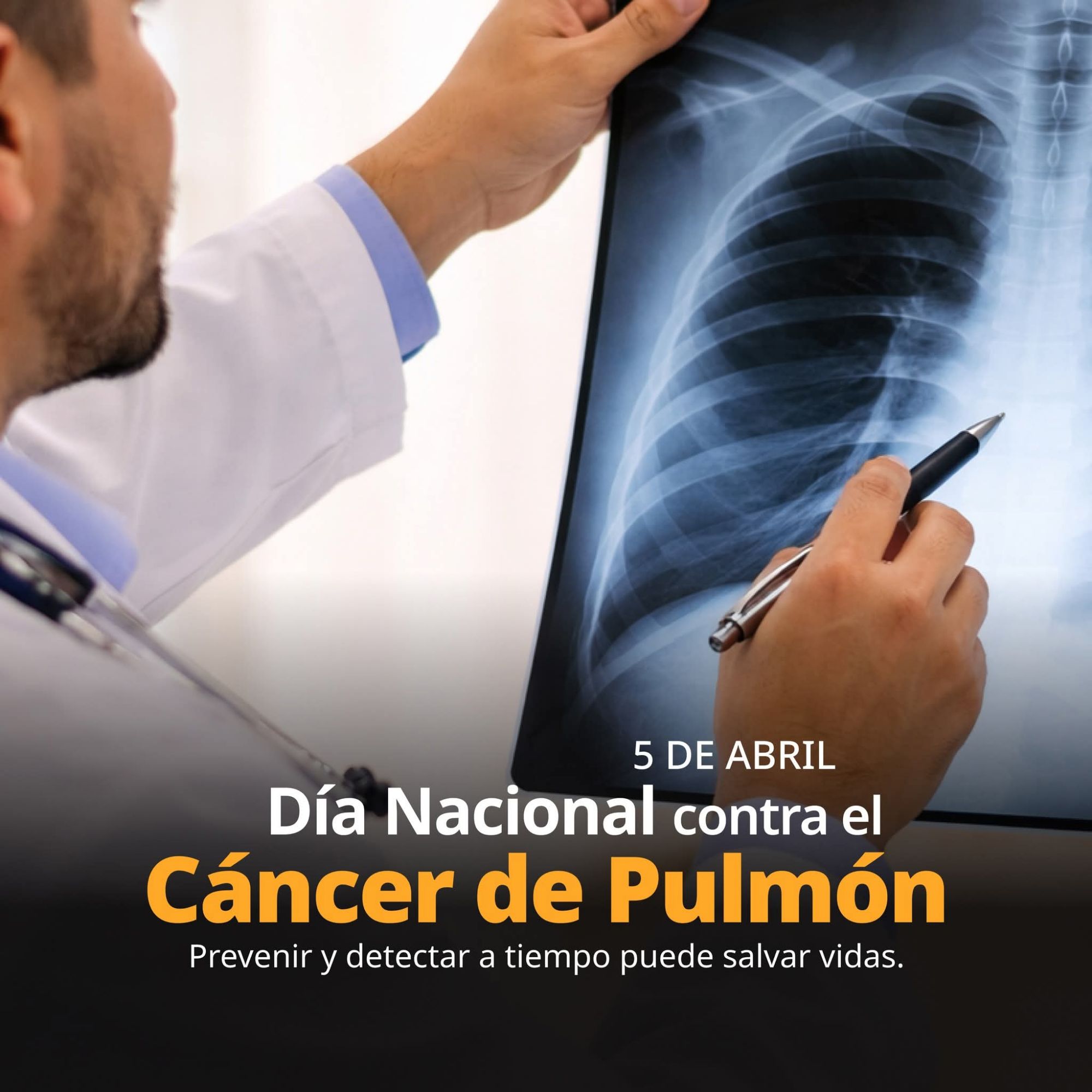 Se suma SESA Querétaro a la conmemoración del Día Nacional Contra el Cáncer de Pulmón